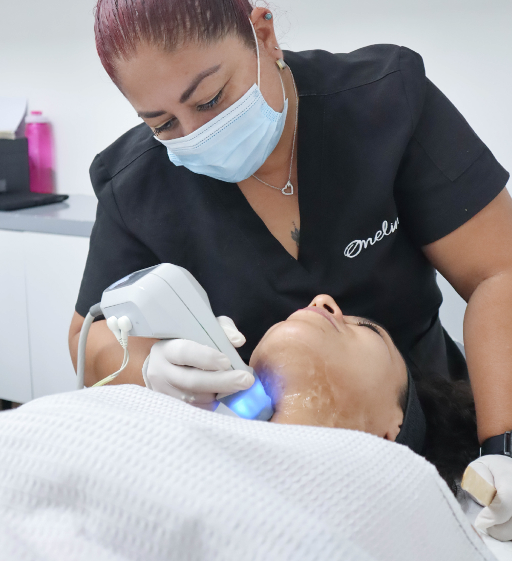 Exilis Facial en Oneline Beuaty Clinic