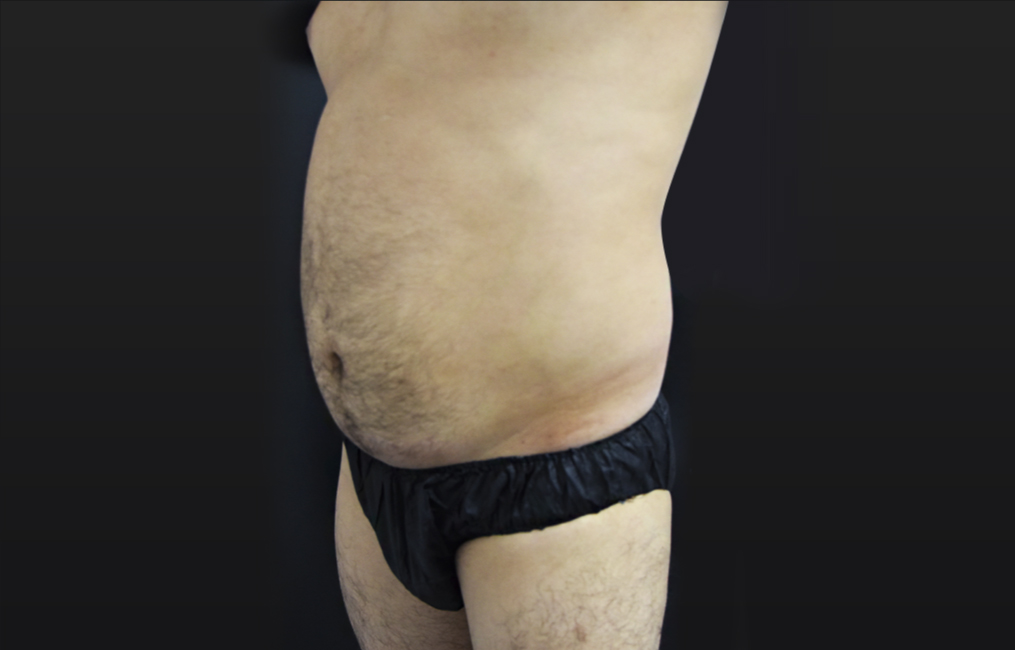 Vanquish treatments