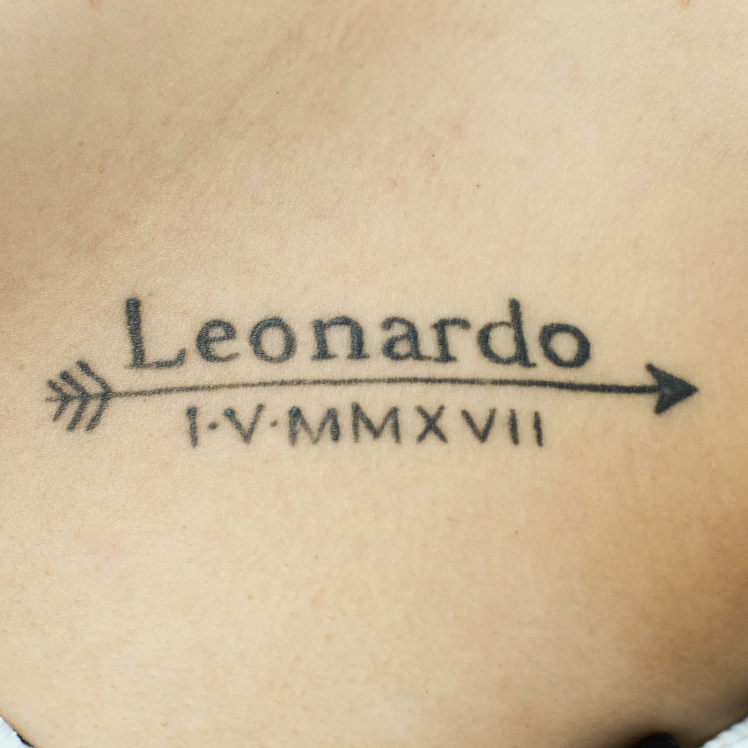 Tratamiento Eliminación de tatuajes