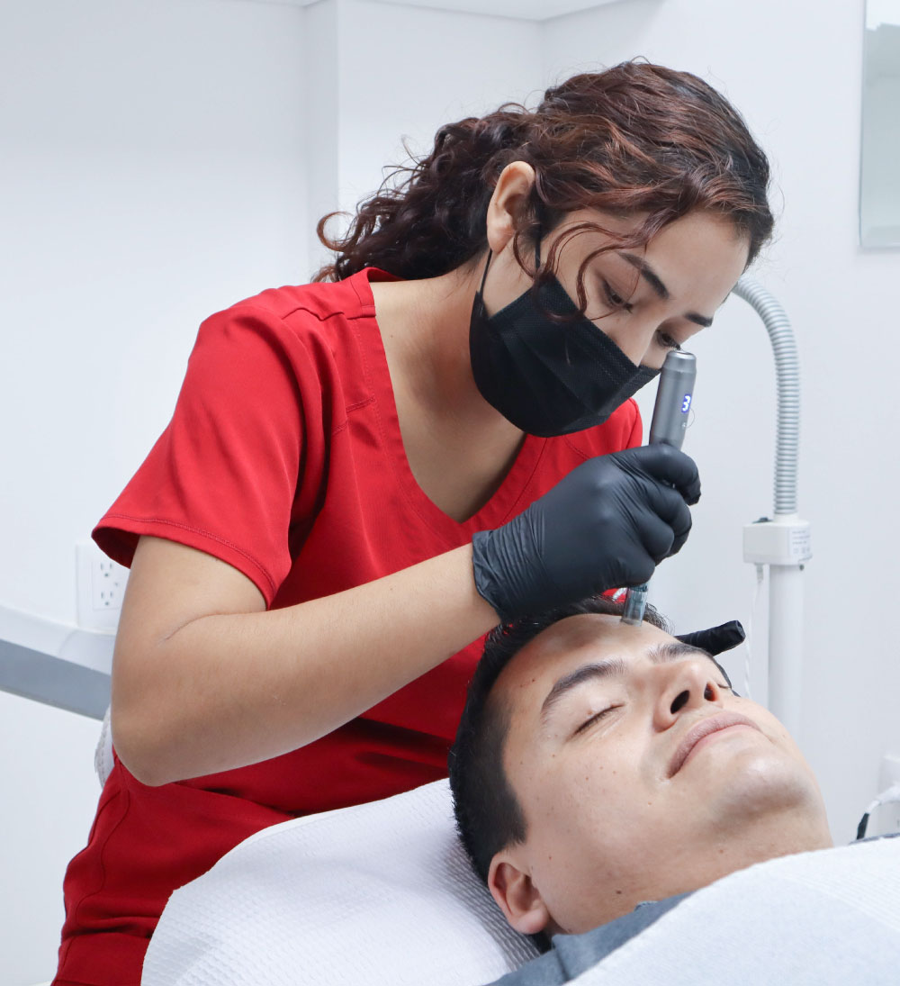 Mecroneedling Dermapen Capilar